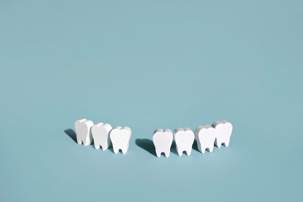 Tooth Extractions in Glendale and Parker
