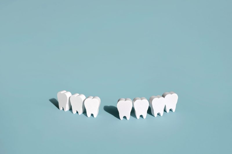 Tooth Extractions in Glendale and Parker