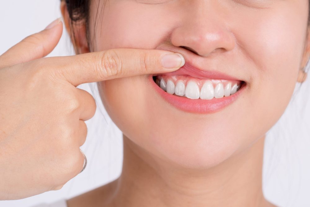 Best Periodontist Glendale